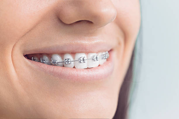 Best Invisalign and Clear Aligners  in Honaker, VA